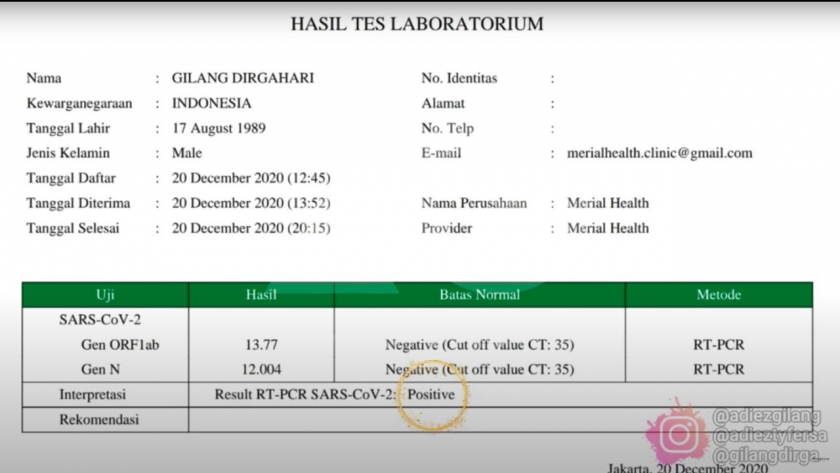 Hasil tes Gilang Dirga positif Covid-19. (Foto : PMJ/YouTube). 